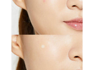 COSRX Acne Pimple Master Patch, 24 Pflaster, Aknepflaster, koreanische Hautpflege